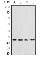 LIPF / GL / Gastric Lipase Antibody - Western blot analysis of Gastric Lipase expression in MCF7 (A); mouse lung (B); mouse liver (C); rat kidney (D) whole cell lysates.