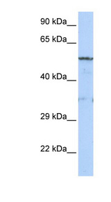 LIPG / Endothelial Lipase Antibody - LIPG antibody Western blot of MCF7 cell lysate. This image was taken for the unconjugated form of this product. Other forms have not been tested.