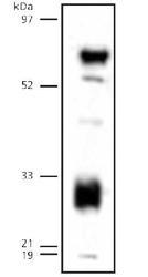 LIPG / Endothelial Lipase Antibody - Endothelial Lipase Antibody - Human endothelial lipase detected in transfected 293 lysates (MW 57 kDa).  This image was taken for the unconjugated form of this product. Other forms have not been tested.