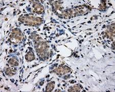 LIPG / Endothelial Lipase Antibody - IHC of paraffin-embedded breast tissue using anti-LIPG mouse monoclonal antibody. (Dilution 1:50).