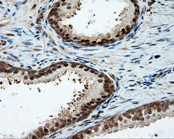 LIPG / Endothelial Lipase Antibody - Immunohistochemical staining of paraffin-embedded prostate tissue using anti-LIPG mouse monoclonal antibody. (Dilution 1:50).