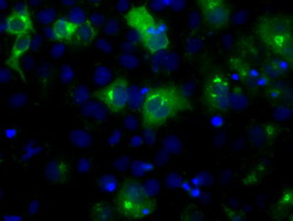 LIPG / Endothelial Lipase Antibody - Anti-LIPG mouse monoclonal antibody  immunofluorescent staining of COS7 cells transiently transfected by pCMV6-ENTRY LIPG.