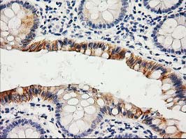 LIPG / Endothelial Lipase Antibody - IHC of paraffin-embedded Human colon tissue using anti-LIPG mouse monoclonal antibody.
