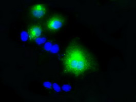 LIPG / Endothelial Lipase Antibody - Anti-LIPG mouse monoclonal antibody immunofluorescent staining of COS7 cells transiently transfected by pCMV6-ENTRY LIPG.