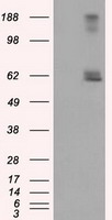 LIPG / Endothelial Lipase Antibody - HEK293T cells were transfected with the pCMV6-ENTRY control (Left lane) or pCMV6-ENTRY LIPG (Right lane) cDNA for 48 hrs and lysed. Equivalent amounts of cell lysates (5 ug per lane) were separated by SDS-PAGE and immunoblotted with anti-LIPG.