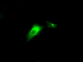 LIPG / Endothelial Lipase Antibody - Anti-LIPG mouse monoclonal antibody  immunofluorescent staining of COS7 cells transiently transfected by pCMV6-ENTRY LIPG.