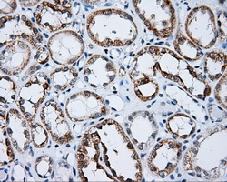 LIPG / Endothelial Lipase Antibody - Immunohistochemical staining of paraffin-embedded Kidney tissue using anti-LIPG mouse monoclonal antibody. (Dilution 1:50).