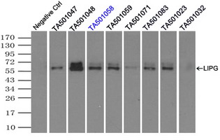 LIPG / Endothelial Lipase Antibody - Immunoprecipitation(IP) of LIPG by using monoclonal anti-LIPG antibodies (Negative control: IP without adding anti-LIPG antibody.). For each experiment, 500ul of DDK tagged LIPG overexpression lysates (at 1:5 dilution with HEK293T lysate), 2 ug of anti-LIPG antibody and 20ul (0.1 mg) of goat anti-mouse conjugated magnetic beads were mixed and incubated overnight. After extensive wash to remove any non-specific binding, the immuno-precipitated products were analyzed with rabbit anti-DDK polyclonal antibody.