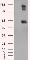 LIPG / Endothelial Lipase Antibody - HEK293T cells were transfected with the pCMV6-ENTRY control (Left lane) or pCMV6-ENTRY LIPG (Right lane) cDNA for 48 hrs and lysed. Equivalent amounts of cell lysates (5 ug per lane) were separated by SDS-PAGE and immunoblotted with anti-LIPG.