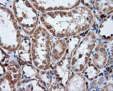 LIPG / Endothelial Lipase Antibody - IHC of paraffin-embedded Kidney tissue using anti-LIPG mouse monoclonal antibody. (Dilution 1:50).