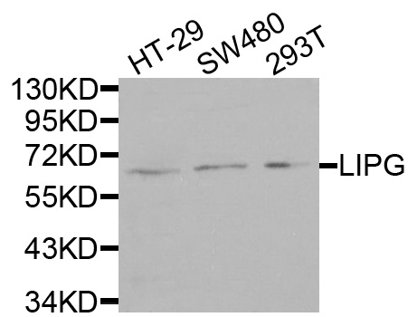 LIPG / Endothelial Lipase Antibody - Western blot analysis of extracts of mouse testis cells.