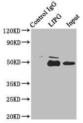 LIPG / Endothelial Lipase Antibody - Immunoprecipitating LIPG in HepG2 whole cell lysate Lane 1: Rabbit control IgG instead of LIPG Antibody in HepG2 whole cell lysate.For western blotting, a HRP-conjugated Protein G antibody was used as the secondary antibody (1/2000) Lane 2: LIPG Antibody (8µg) + HepG2 whole cell lysate (500µg) Lane 3: HepG2 whole cell lysate (10µg)