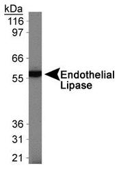 LIPG / Endothelial Lipase Antibody - Endothelial Lipase Antibody - Western blot analysis of Endothelial Lipase in ECV304 cells.  This image was taken for the unconjugated form of this product. Other forms have not been tested.