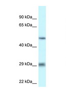 LIPH / Lipase Member H Antibody - LIPH antibody Western blot of 1 Cell lysate. Antibody concentration 1 ug/ml.  This image was taken for the unconjugated form of this product. Other forms have not been tested.