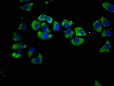 LIPH / Lipase Member H Antibody - Immunofluorescence staining of A549 cells at a dilution of 1:66, counter-stained with DAPI. The cells were fixed in 4% formaldehyde, permeabilized using 0.2% Triton X-100 and blocked in 10% normal Goat Serum. The cells were then incubated with the antibody overnight at 4 °C.The secondary antibody was Alexa Fluor 488-congugated AffiniPure Goat Anti-Rabbit IgG (H+L) .