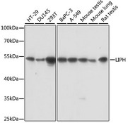 LIPH / Lipase Member H Antibody - Western blot analysis of extracts of various cell lines, using LIPH antibody at 1:1000 dilution. The secondary antibody used was an HRP Goat Anti-Rabbit IgG (H+L) at 1:10000 dilution. Lysates were loaded 25ug per lane and 3% nonfat dry milk in TBST was used for blocking. An ECL Kit was used for detection and the exposure time was 10s.
