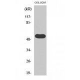 LIPI Antibody - Western blot of LPD lipase antibody