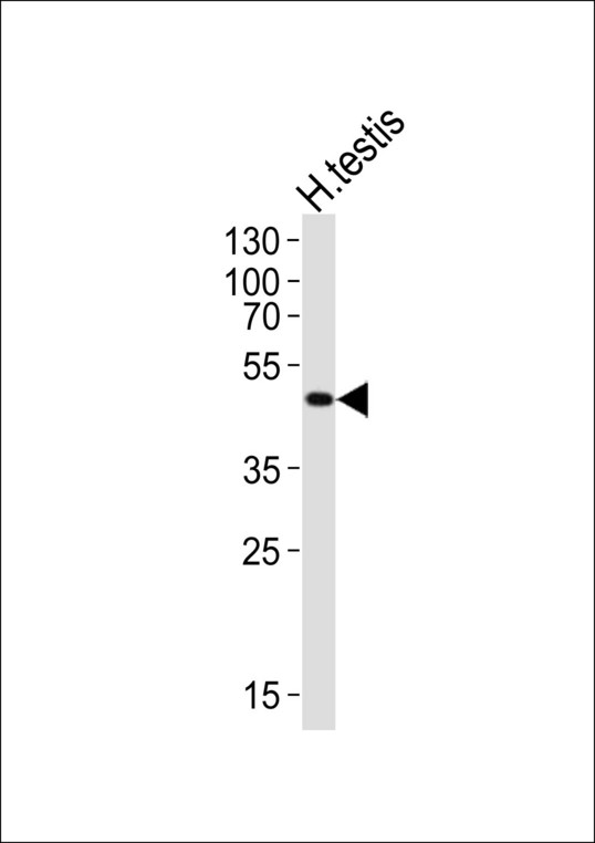 LIPI Antibody - Western blot of lysate from human testis tissue lysate, using LIPI antibody diluted at 1:1000. A goat anti-rabbit IgG H&L (HRP) at 1:10000 dilution was used as the secondary antibody. Lysate at 20 ug.