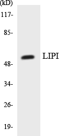 LIPI Antibody - Western blot analysis of the lysates from HepG2 cells using LIPI antibody.