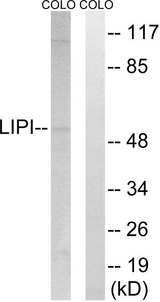 LIPI Antibody - Western blot analysis of lysates from COLO cells, using LIPI Antibody. The lane on the right is blocked with the synthesized peptide.