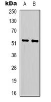 LIPI Antibody - Western blot analysis of LIPI expression in Jurkat (A); HepG2 (B) whole cell lysates.