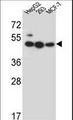 LIPJ Antibody - LIPJ Antibody western blot of HepG2,293,MCF-7 cell line lysates (35 ug/lane). The LIPJ antibody detected the LIPJ protein (arrow).