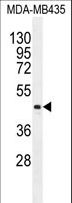 LIPK Antibody - LIPK Antibody western blot of MDA-MB435 cell line lysates (35 ug/lane). The LIPK antibody detected the LIPK protein (arrow).