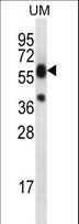 LIPM / LIPL3 Antibody - LIPM Antibody western blot of uterus tumor cell line lysates (35 ug/lane). The LIPM antibody detected the LIPM protein (arrow).