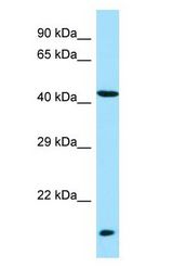 LIPM / LIPL3 Antibody - LIPM / LIPL3 antibody Western Blot of Fetal Liver.  This image was taken for the unconjugated form of this product. Other forms have not been tested.