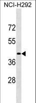 LIPN Antibody - LIPN Antibody western blot of NCI-H292 cell line lysates (35 ug/lane). The LIPN antibody detected the LIPN protein (arrow).