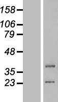 LIPT1 Protein - Western validation with an anti-DDK antibody * L: Control HEK293 lysate R: Over-expression lysate