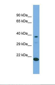LIPT2 Antibody - Western blot of Human 293T. LIPT2 antibody dilution 1.0 ug/ml.  This image was taken for the unconjugated form of this product. Other forms have not been tested.