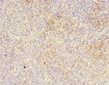 LITAF Antibody - Immunohistochemistry of paraffin-embedded human thymus tissue at dilution 1:100