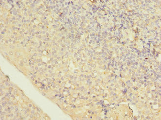 LITAF Antibody - Immunohistochemistry of paraffin-embedded human tonsil tissue at dilution 1:100