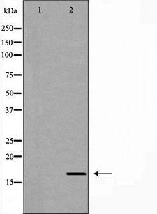 LITAF Antibody - Western blot analysis of HeLa whole cells lysates using LITAF antibody. The lane on the left is treated with the antigen-specific peptide.