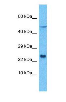 LITAF Antibody - Western blot of LITAF Antibody with human 786-0 Whole Cell lysate.  This image was taken for the unconjugated form of this product. Other forms have not been tested.