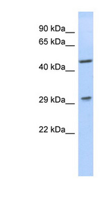 LIX1 Antibody - LIX1 antibody Western blot of Jurkat lysate. This image was taken for the unconjugated form of this product. Other forms have not been tested.