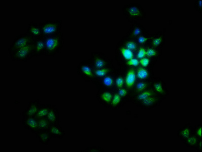 LIX1 Antibody - Immunofluorescence staining of PC3 cells with LIX1 Antibody at 1:16, counter-stained with DAPI. The cells were fixed in 4% formaldehyde, permeabilized using 0.2% Triton X-100 and blocked in 10% normal Goat Serum. The cells were then incubated with the antibody overnight at 4°C. The secondary antibody was Alexa Fluor 488-congugated AffiniPure Goat Anti-Rabbit IgG(H+L).