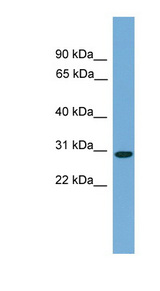 LKAAEAR1 / C20orf201 Antibody - C20orf201 antibody Western blot of Fetal Liver lysate. This image was taken for the unconjugated form of this product. Other forms have not been tested.