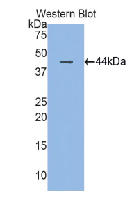 LL37 / Cathelicidin Antibody - Western blot of recombinant LL37 / CAMP / Cathelicidin.  This image was taken for the unconjugated form of this product. Other forms have not been tested.