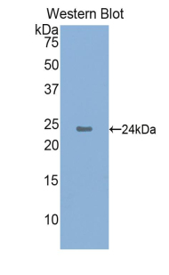 LL37 / Cathelicidin Antibody - Western blot of recombinant LL37 / CAMP / Cathelicidin.  This image was taken for the unconjugated form of this product. Other forms have not been tested.