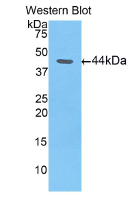 LL37 / Cathelicidin Antibody - Western blot of recombinant LL37 / CAMP / Cathelicidin.  This image was taken for the unconjugated form of this product. Other forms have not been tested.