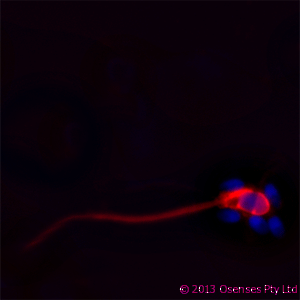 LL37 / Cathelicidin Antibody - Mouse monoclonal to Cathelicidin: OSX12 clone. IF on ethanol-fixed human spermatozoid using Mouse monoclonal to Cathelicidin: OSX12 clone at a concentration of 10 ug/ml. DAPI counterstained appearing in blue.