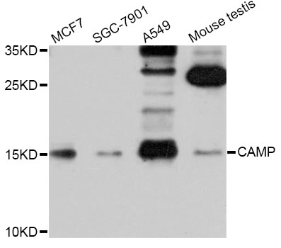 LL37 / Cathelicidin Antibody - Western blot analysis of extracts of various cell lines, using CAMP antibody at 1:1000 dilution. The secondary antibody used was an HRP Goat Anti-Rabbit IgG (H+L) at 1:10000 dilution. Lysates were loaded 25ug per lane and 3% nonfat dry milk in TBST was used for blocking. An ECL Kit was used for detection and the exposure time was 60s.