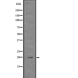 LL37 / Cathelicidin Antibody - Western blot analysis of Cathelicidin using COLO205 whole lysates.