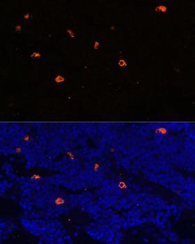 LL37 / Cathelicidin Antibody - Immunofluorescence analysis of Rat bone marrow using CAMP Polyclonal Antibody at dilution of 1:100.Blue: DAPI for nuclear staining.