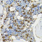LL37 / Cathelicidin Antibody - Immunohistochemistry of paraffin-embedded Rat bone marrow using CAMP Polyclonal Antibody at dilution of 1:200 (40x lens).