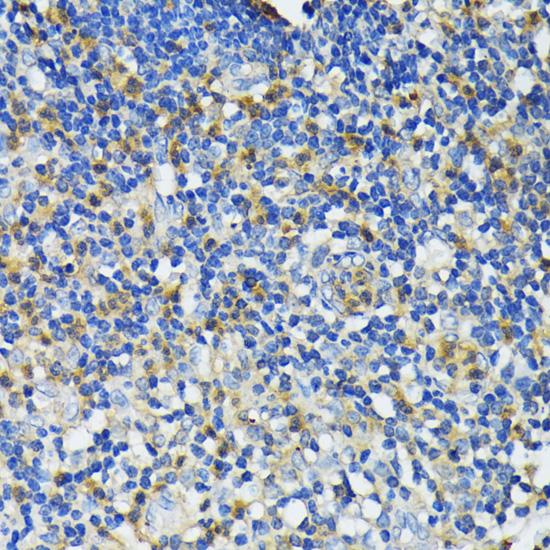 LL37 / Cathelicidin Antibody - Immunohistochemistry of paraffin-embedded Human appendix using CAMP Polyclonal Antibody at dilution of 1:200 (40x lens).