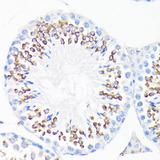 LL37 / Cathelicidin Antibody - Immunohistochemistry of paraffin-embedded Mouse testis using CAMP Polyclonal Antibody at dilution of 1:200 (40x lens).