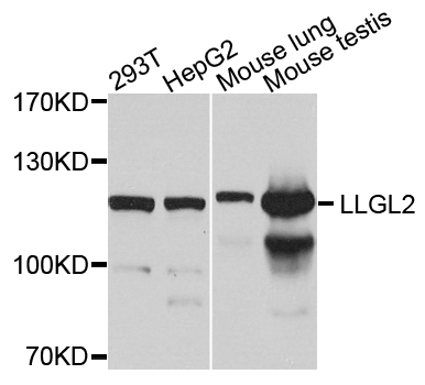 LLGL2 Antibody - Western blot blot of extracts of various cells, using LLGL2 antibody.